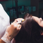 Kadınlar İçin Saç Ekimi